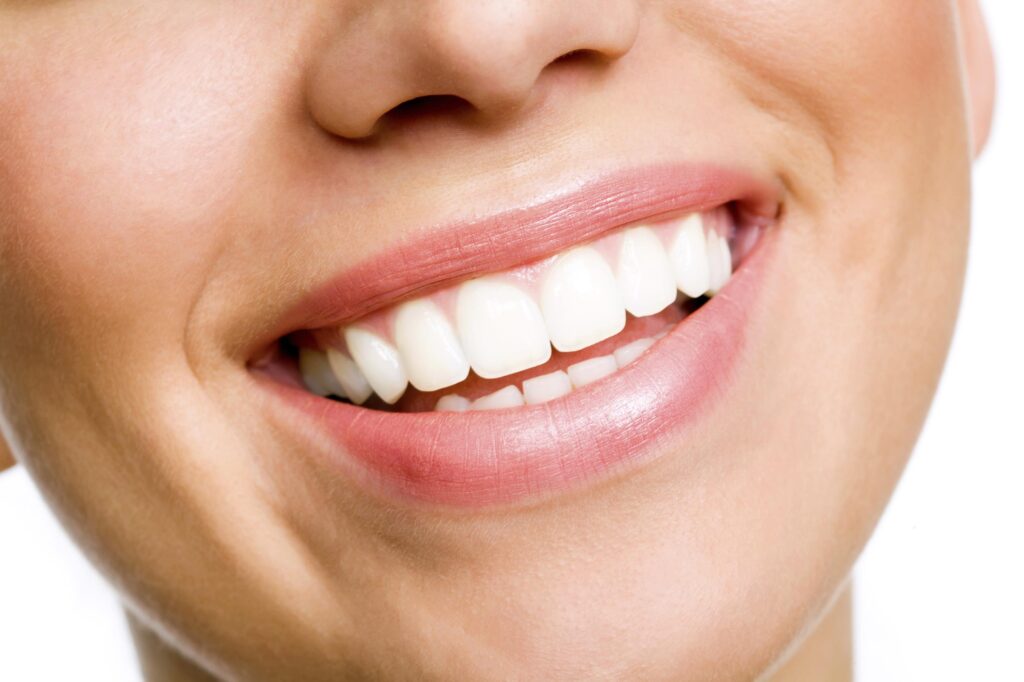 Teeth Whitening Northern Beaches